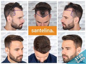 dental treatment turkey