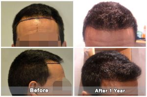 dental treatment turkey