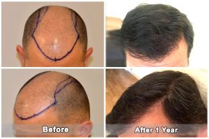 dental treatment turkey