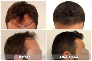 dental treatment turkey