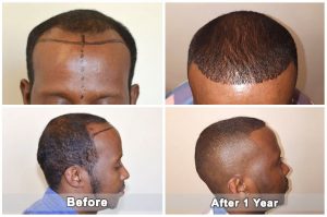 dental treatment turkey