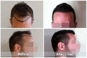 dental treatment turkey